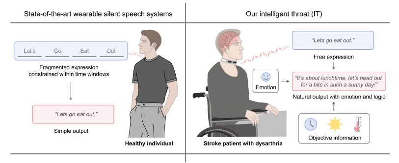 Chinese team investigates LLMs to help stroke victims speak